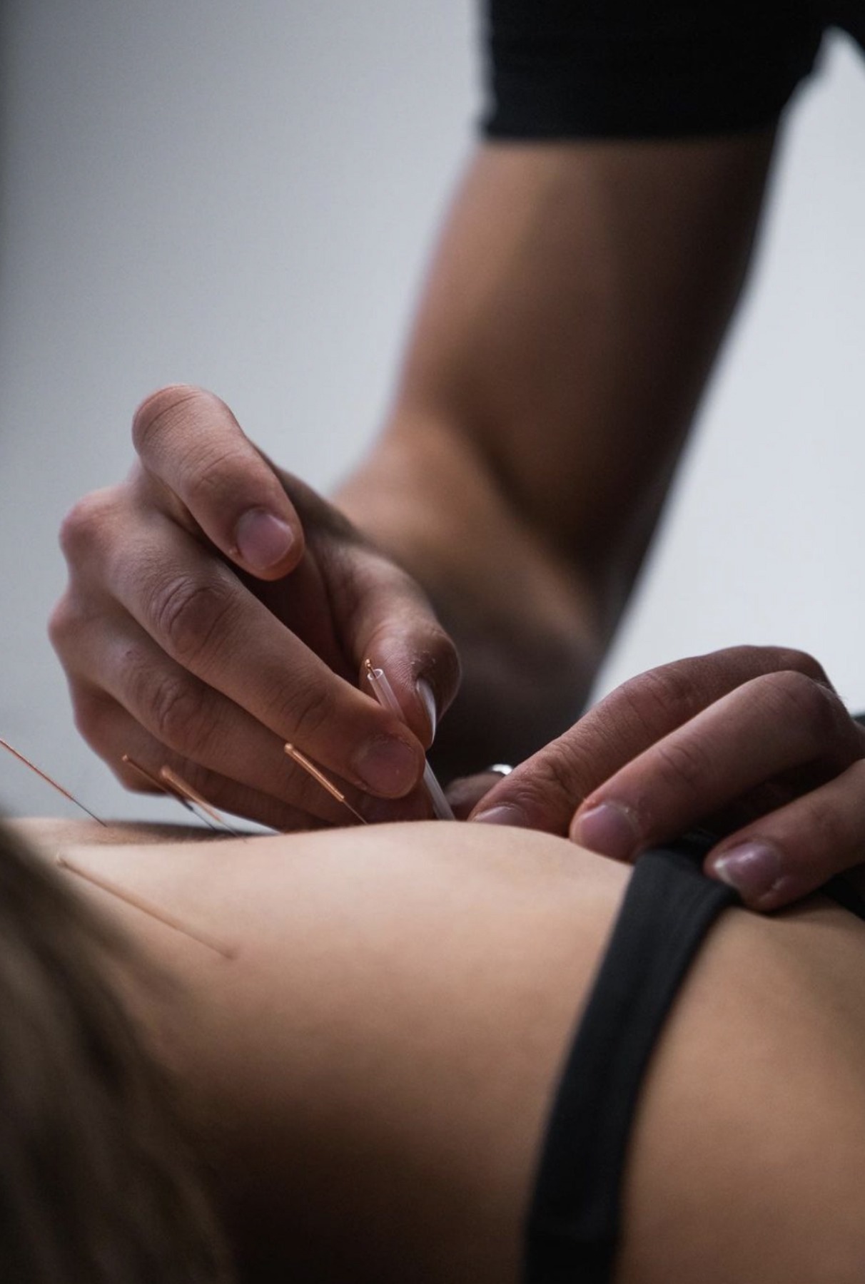 Features Footscray Studio - Osteopathy Back Needling - The Spinal Studio